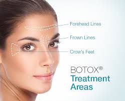 3 zone botox